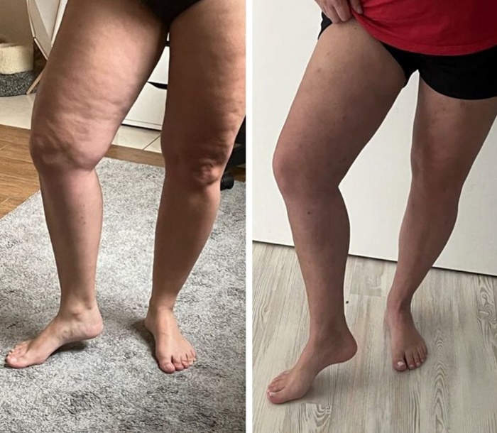 Rodilla — representación después del protocolo